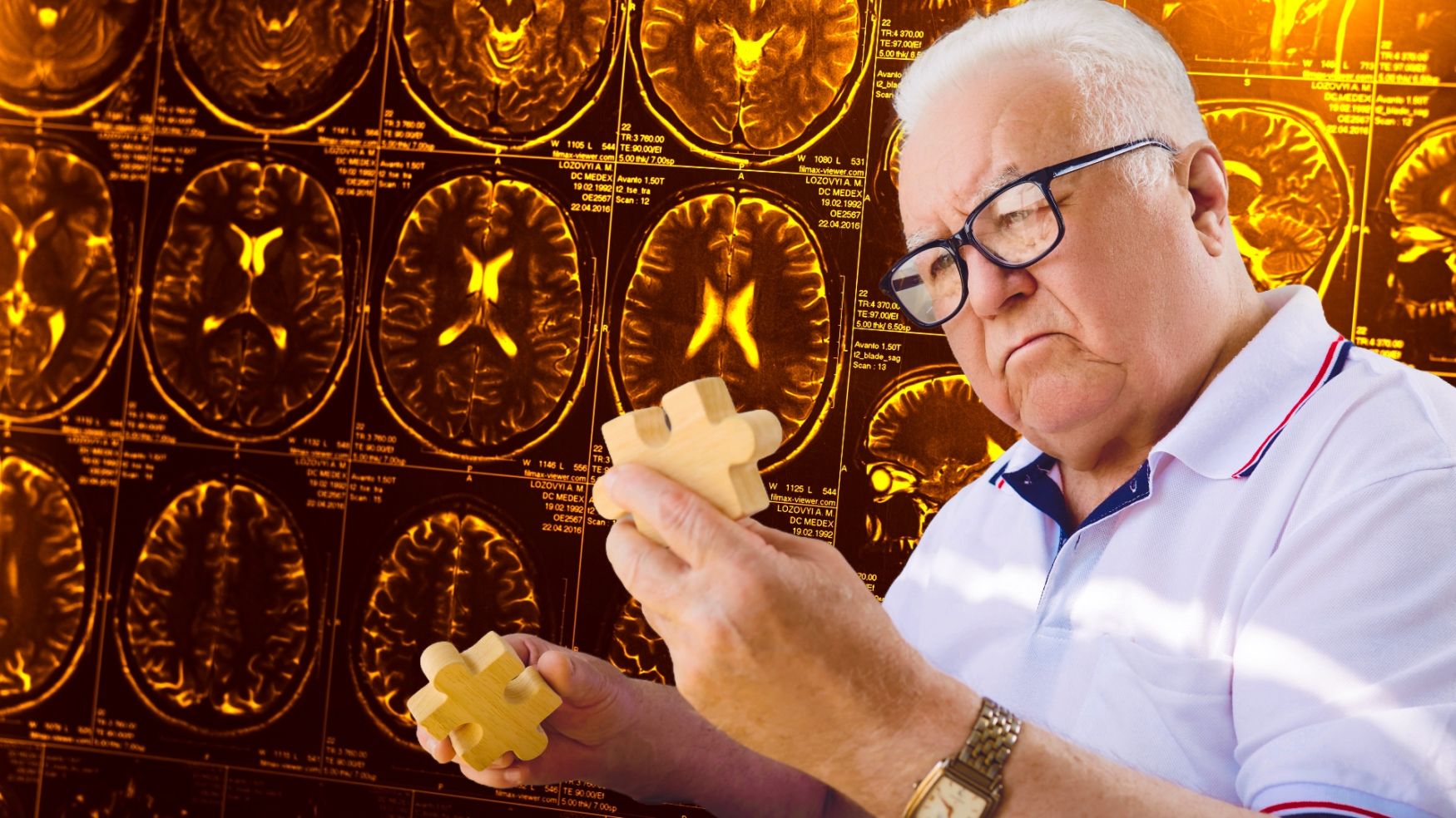 Keeping your mind active throughout life may lower Alzheimer’s risk